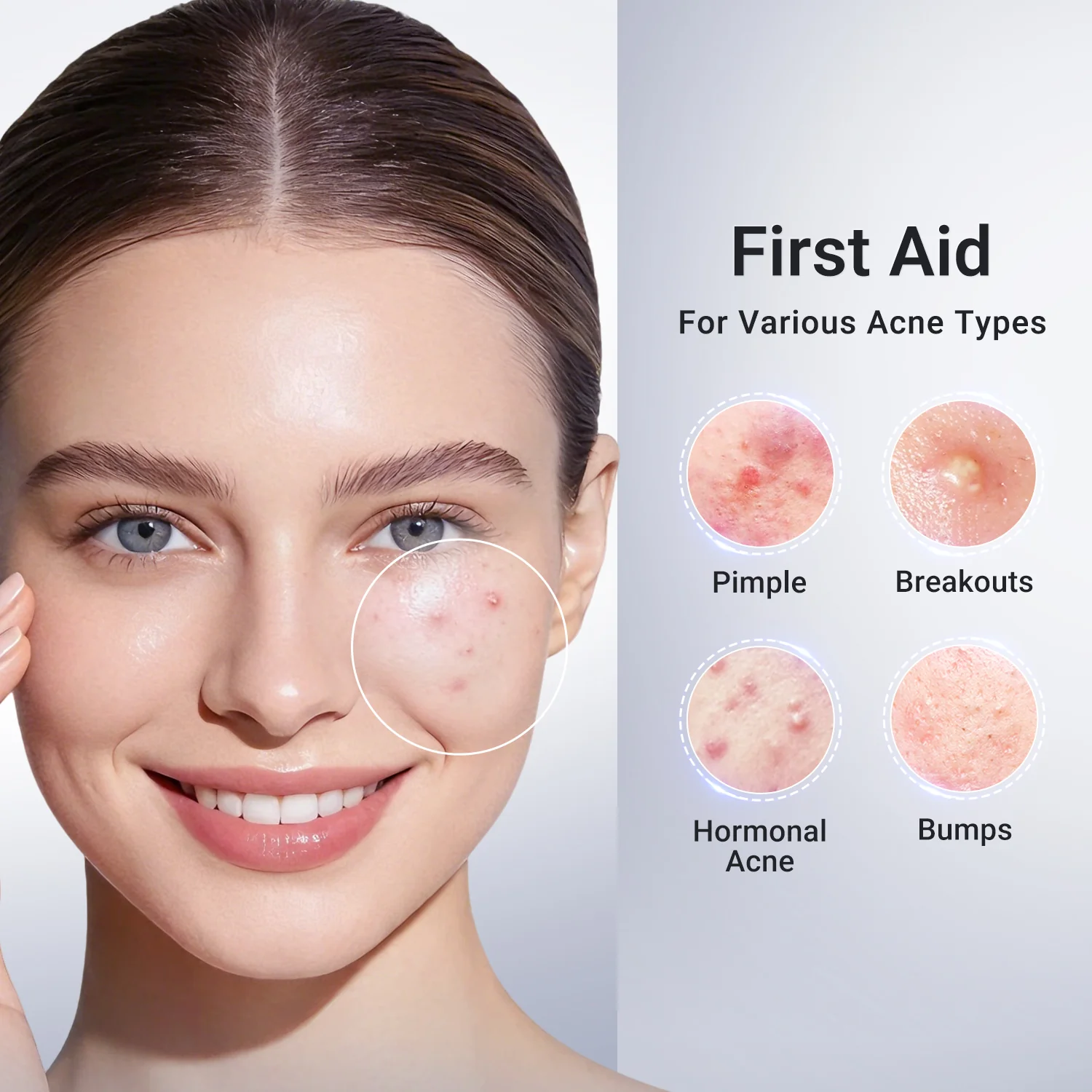 3-Step Acne Control Routine (Cleanser + Cleansing Clay Stick + Drying Lotion Plus) - Image 7