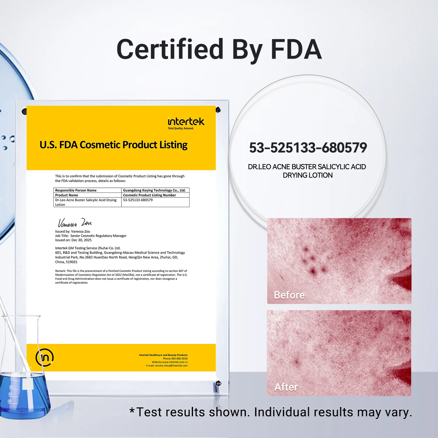 Acne Drying Lotion Plus — 3 Pack (20 mL × 3) - Image 6