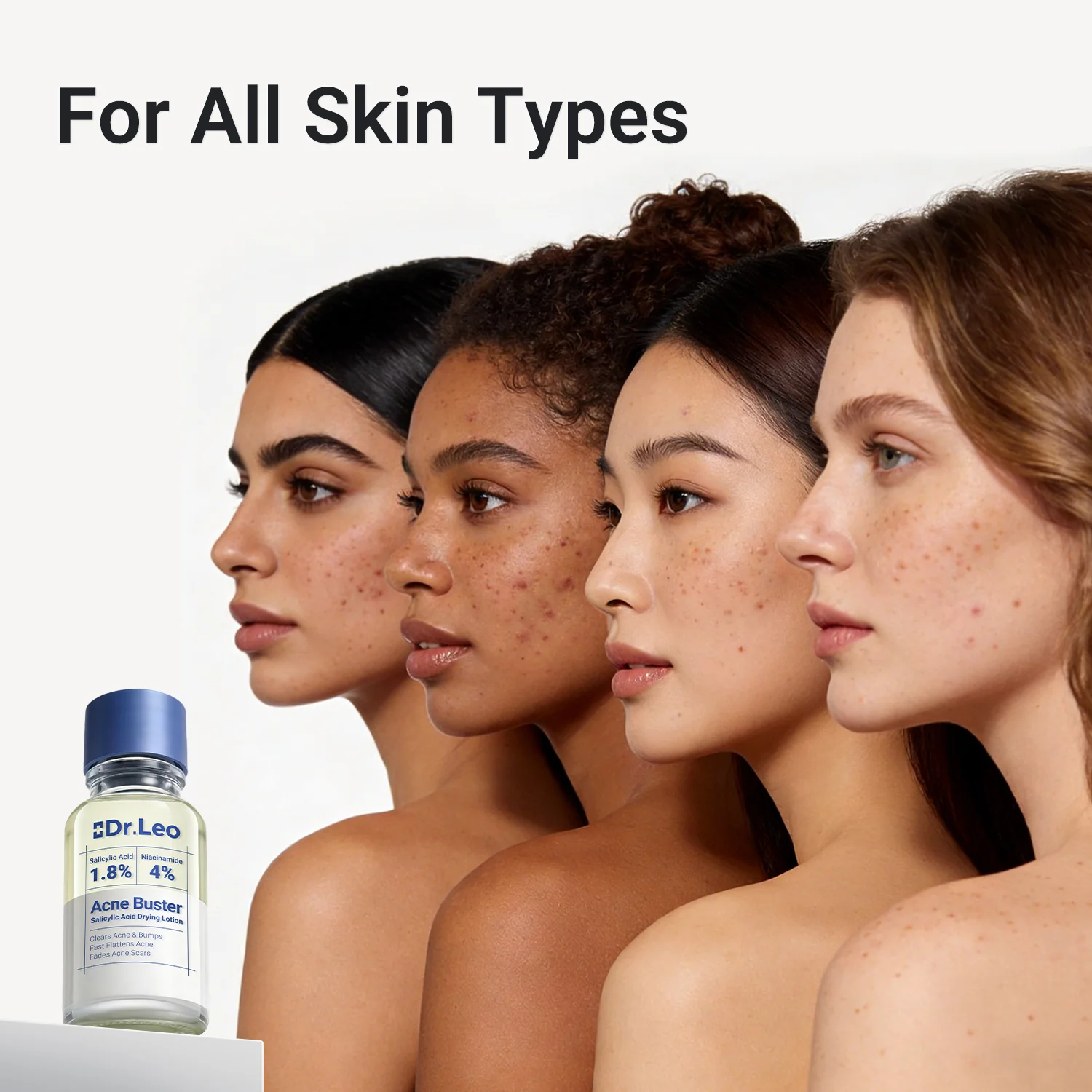 Acne Drying Lotion Plus — 3 Pack (20 mL × 3) - Image 9